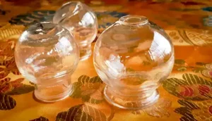 Ventouses chinoises - sophie bouvier - Illkirch - strasbourg